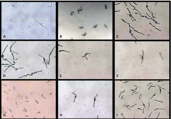 Figura 3: Padrões de germinação observados nas culturas identificadas. Padrão D, típico de  Mycosphaerella parkii,  padrão  F, típico de Mycosphaerella juvenis, padrão  G, típico de  Mycosphaerella africana padrão H, típico de Mycosphaerella mexicana, padr