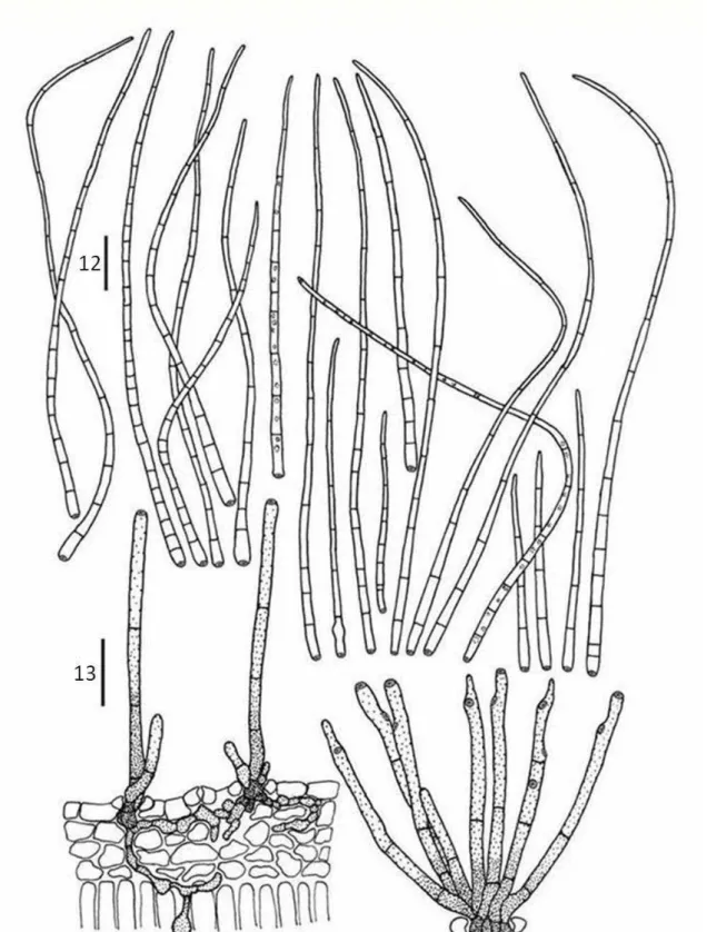 Figs 12-13. Cercospora apii (VIC 30569) 12. Acicular conidia. 13. Conidiophores arising through stomata 