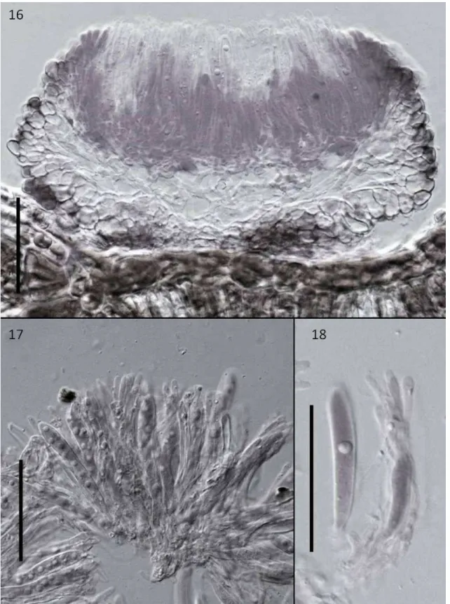 Figs 16-18.  Mollisia  tibouchinae (VIC 30667) 16 Apothecium. Bar=50  μm.  17 Asci and ascospores