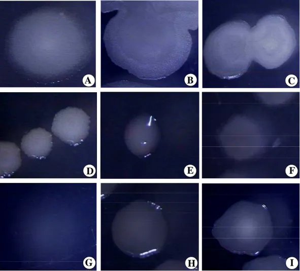 Figura 3. Colônias de rizobactérias cultivadas em meio 523, após 24 h de  incubação. (A) isolado S1 - Bacillus  subtilis; (B) S2 – B