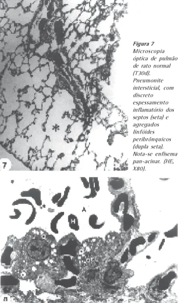 Figura 8 – Eletron-micrografia de pulmão de rato injetado com AO (T2h).