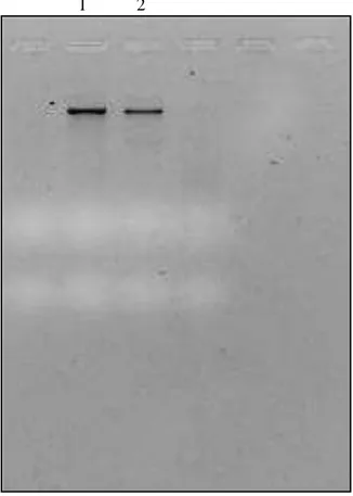 Figura 5. Gel de agarose 1% evidenciando a banda correspondente ao DNA bacteriano  de endossimbiontes presentes nos ácaros T