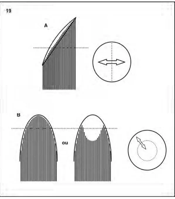 Figura 19A e B: Esquema de cortes transversais e longitudinais de feixes de Hymenoptera