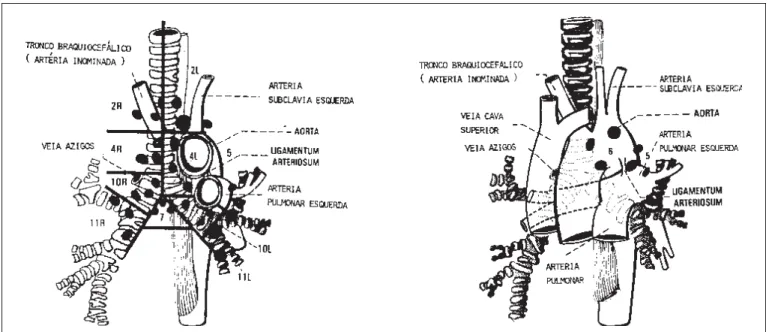 Figura 1 – Mapa do mediastino idealizado pela ATS e aceito internacionalmente a partir de 1983
