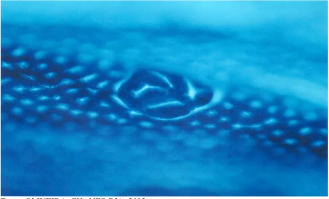 Figura 2-  Foco de cripta aberrante (FCA) com quatro criptas aberrantes observadas  na   superfície da mucosa colônica, com microscópio óptico de luz (100X), depois de corada  com azul de metileno (0,1%)
