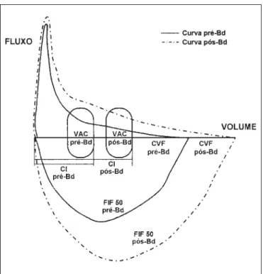 Figura 2 – Resposta a Bd na curva fluxo-volume com: 1) aumento da CI; 2) aumento da CVF e 3) aumento dos fluxos inspiratórios.