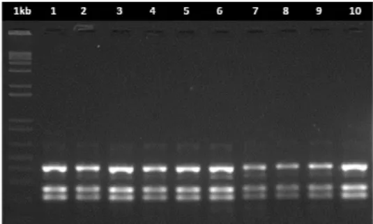Figure  3.2  -  Electrophoretic  pattern  on  agarose  gel  of  amplified  mtCOI  digested  with  the  enzyme  TaqI