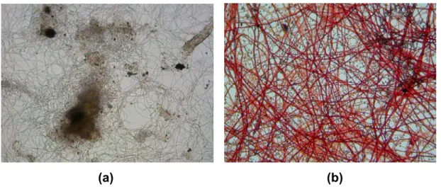 Figura 4.1 – Microfotografias de contraste de fase do lodo biológico utilizado 