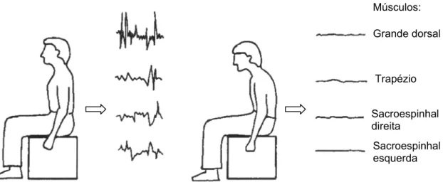 Figura 2: Atividade elétrica (EMG) nos músculos das costas  na posição ereta e levemente flexionada à frente