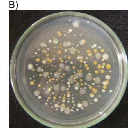 Figura 4  - Placas de microrganismos aeróbios mesófilos na sala de processamento de 