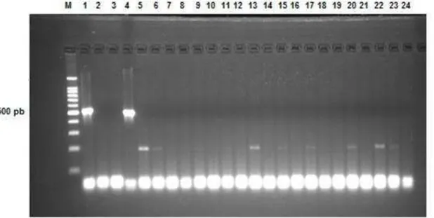Figura 2- Visualização do produto de PCR para identificação de L. monocytogenes. 