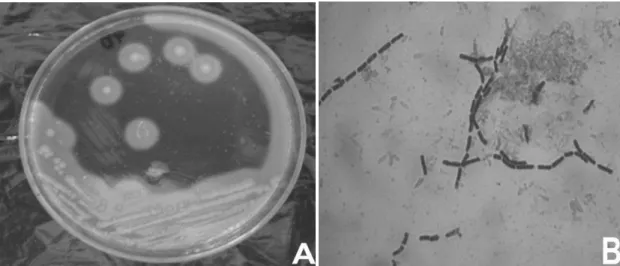 Figura 9 - Colônias típicas de Bacillus cereus isoladas em  meio seletivo MYP.   (A) halo de lecitinase e não-fermentação de manitol, (B) bastonetes longos, com  bordas retangulares, gram-positivos 
