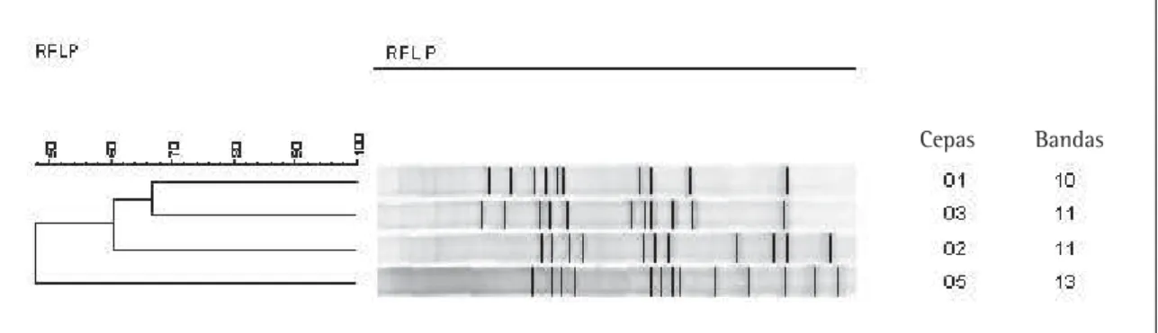Figura 1 -  Perfil dos quatro isolados de  M. tuberculosis  definidos através do RFLP- IS 6110