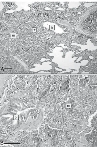 Figura 3 - Fotos de microscopia óptica  de tecido pulmonar mostrando: A) Bronquíolo constrito (b) com redução parcial do lúmen e sinais de inflamação crônica leve/moderada nas paredes (*), que se extende ao parênquima pulmonar; B) O tecido peribrônquico al