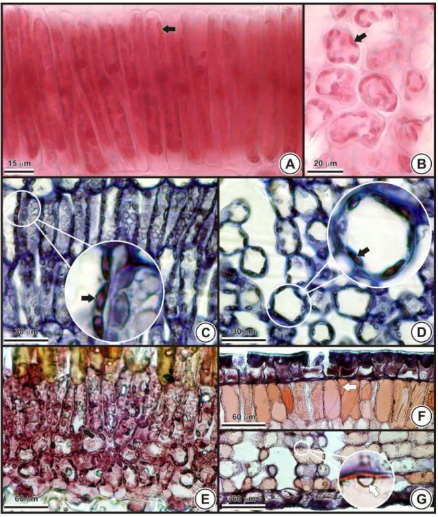 FIGURA 5. Detecção de alumínio em cloroplastos de espécies de Cerrado.  A- A-B. Palicourea rigida: parênquima paliçádico (A) e lacunoso (B)