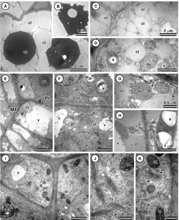 Figura 5.  Células cotiledonares de Passiflora cincinnata durante os estádios iniciais do processo de 