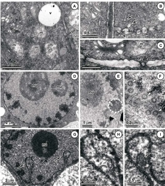 Figura 3. Células de meristemoides e de calo de Passiflora edulis em microscopia eletrônica  de transmissão