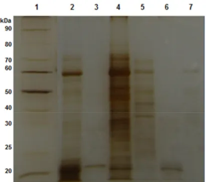 Figura  5  -  Eletroforese  desnaturante  (SDS-PAGE  12%)  de  amostras  contendo 