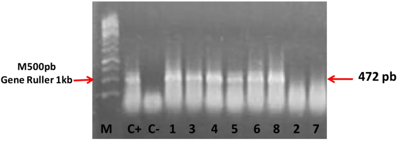FIGURA 2- Padrão eletroforético dos produtos amplificados de 472pb do gene que codifica a proteína VP2  do IBDV pela reação da RT-PCR