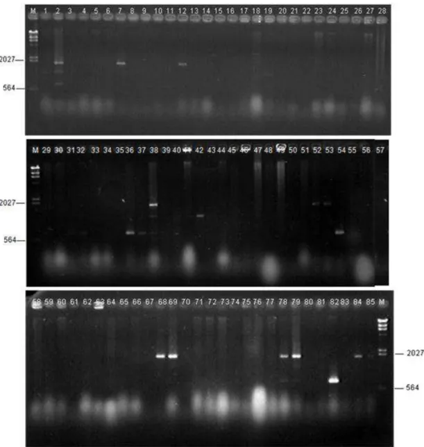 Figura 2A. Avaliação da presença do gene cna em isolados de Staphylococcus aureus,  por  meio  de  análise  eletroforética,  em  gel  de  agarose  1  Número  da  canaleta  corresponde à  identificação do isolado