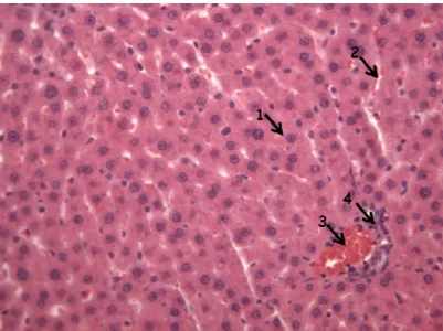 Figura 1: Tecido hepático normal (GI) (aumento de 200X – HE). 1: Hepatócito normal.  2: Sinusóide