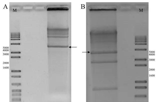Figura 9. Digestão parcial do genoma viral amplificado do PSLDV-[BR:LNS2:Pas:01]  com as enzimas Sal I (A) e Sac I (B)