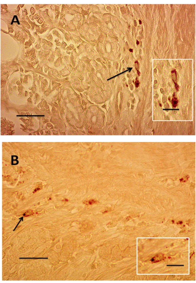Figura  9.  A  e  B.  Células  endócrinas  argentafins  (setas  e  destaque)  da  túnica  mucosa  do  estômago do gambá D