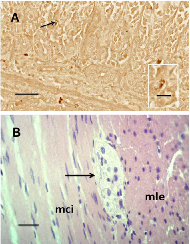 Figura 10. A. Célula endócrina argirófila (seta e destaque) da túnica mucosa do estômago  do  gambá  D.aurita  (Técnica  de  Grimelius)