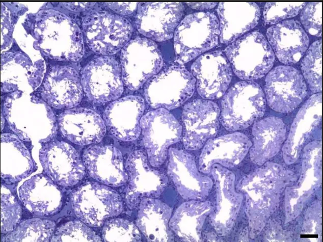 Figura 4: Fotomicrografia do aspecto geral do parênquima testicular observado em dois indivíduos  tratados com 40mgNi  após 60 dias