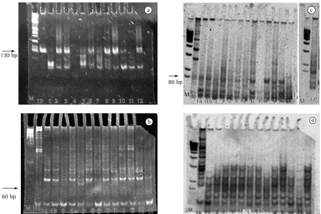 Figura 2 - a) Produtos amplificados da PCR da IgH analisados em gel de poliacrilamida a 10% e corados com brometo  de etídeo: faixa 1 (Caso 13); faixa 2 (Caso 1); faixa 3 (Caso 2); faixa 4 (Caso 3); faixa 5 (Caso 4); faixa 6 (Caso 5); 