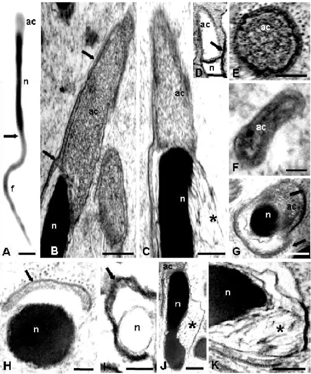Figura 1 . Morfologia do espermatozóide de Apanteles galleriae.  A – Micrografia em 