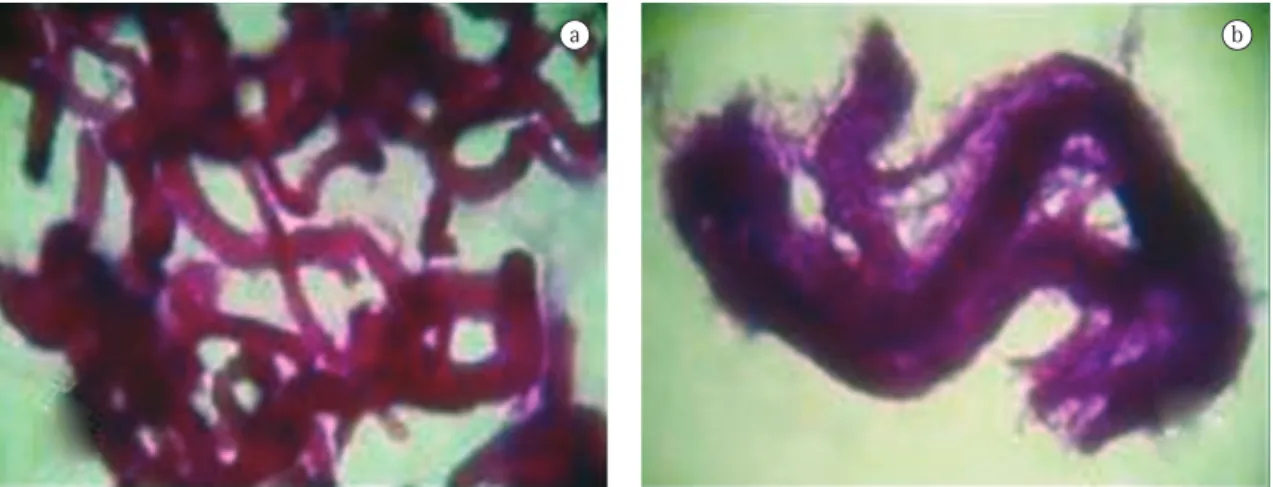 Figure  2  -  Mycobacterium  tuberculosis ,  Ziehl-Neelsen  staining,  optical  microscopy  (1600×):  a)  in  liquid  isolation  medium, presence of cord factor; and b) on solid isolation medium, presence of cord factor.