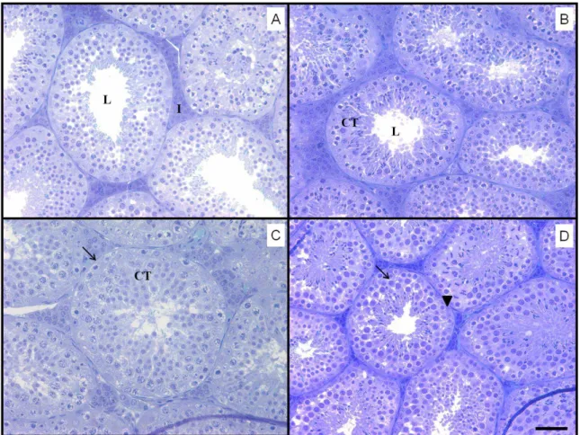 Figura  2:  Secções  transversais  testiculares  de  Artibeus  lituratus,  controle  e  tratados  com espalhante e endossulfam