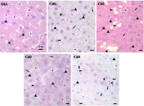 Figura  2.  Fotomicrografias  representativas  do  fígado  de  ratos  Wistar  expostos  a  diferentes  doses  de  Cd