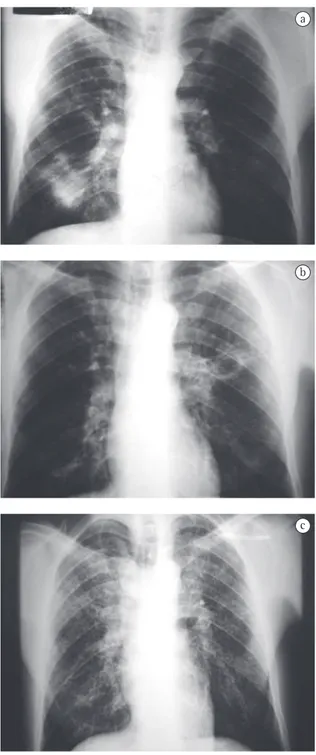 Figura  5  -  Imagens  seqüenciais  do  mesmo  paciente: 