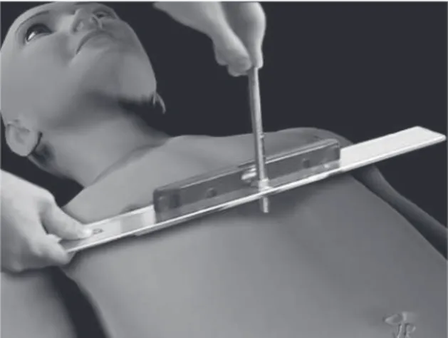 Figure 2 - Measurement B = distance from the point of  greatest  sternum  depth  to  the  highest  point  of  the  rib  cage.