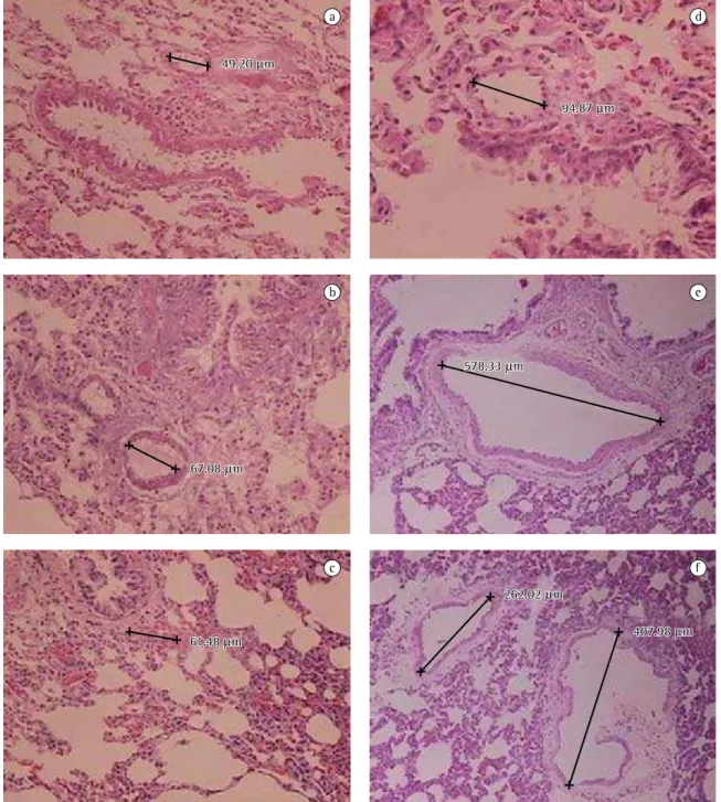 Figura 1 - Fotos de microscopia das amostras de tecido pulmonar coradas com hematoxilina e eosina: a) controle; 