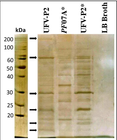 Figure 4-1. Electrophoretic pattern of the UFV-P2 proteins. 