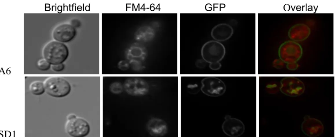 Figure 6 – Lac12GFPp is found inside (JA6) and vacuolar membrane (JSD1-  Klsnf1 mutant)