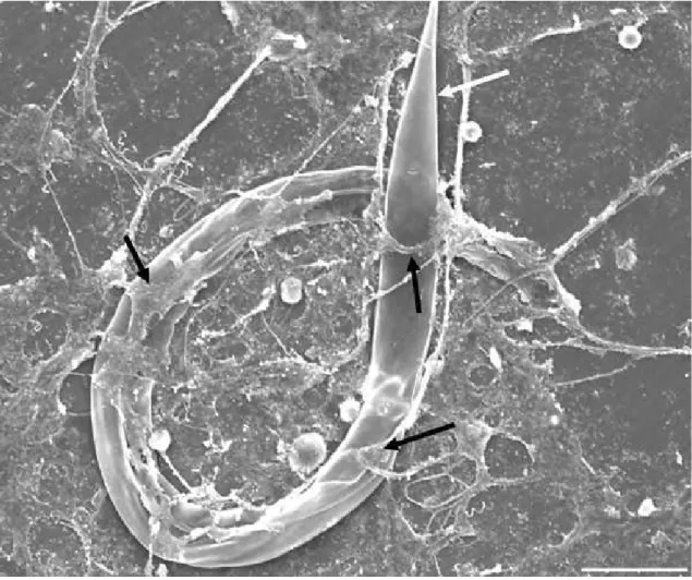 Fig.  6.  SEM  of  infective  larvae  (L3)  of  preyed  Haemonchus  contortus  (white  arrow)  by  predator  nematophagous  fungi  stimulating  the  production  of  traps  (black arrow)