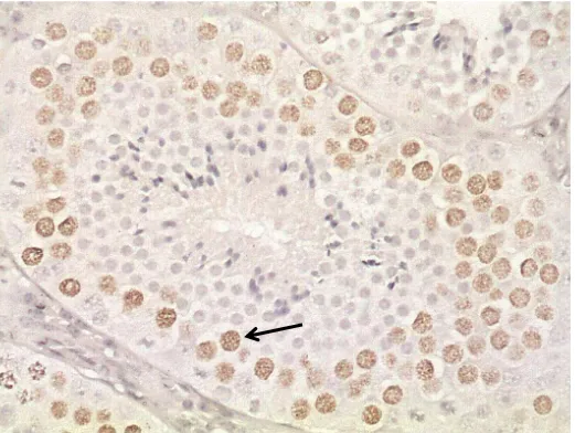 Figura   .    Estádio  II  do  CES  de  Capivara  (Hydrochoerus  hydrochaeris),  demonstrando  imunomarcação (seta) em espermatócitos primários em leptóteno após    dias de aplicação do BrdU