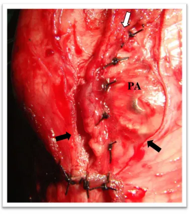 Figura  11.  Imagem  fotográfica  ilustrando  a  sutura  da  cápsula  articular.  Bordas  do  retináculo  (setas  pretas),  suturas na cápsula (seta branca), parafuso e arruela sob a cápsula articular (PA)