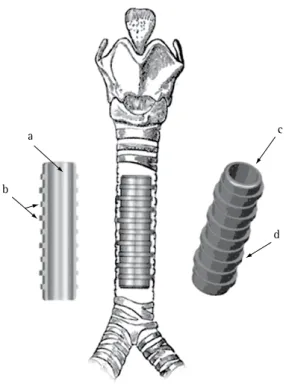 Figura 1 - Principais traços da órtese de silicone HCPA-1: 