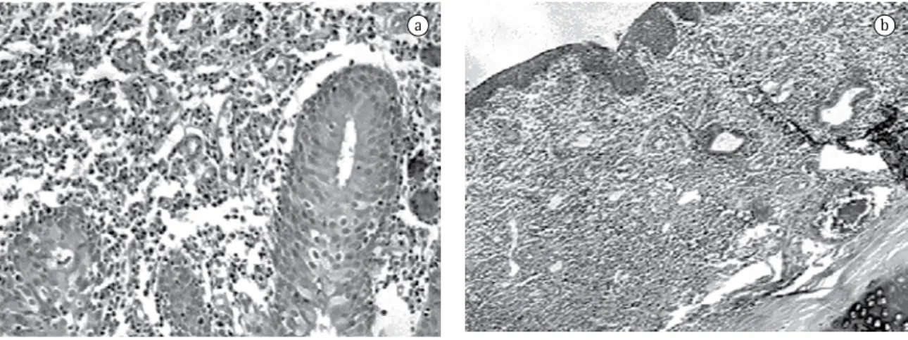 Figura 5 - Resultados seis semanas após a implantação: a superfície interna da traquéia está bem preservada e em  contato com a órtese HCPA-1; a) membrana basal epitelial está intacta ao aumento de 100 × ; e b) embora um discreto  exsudato  inflamatório  s