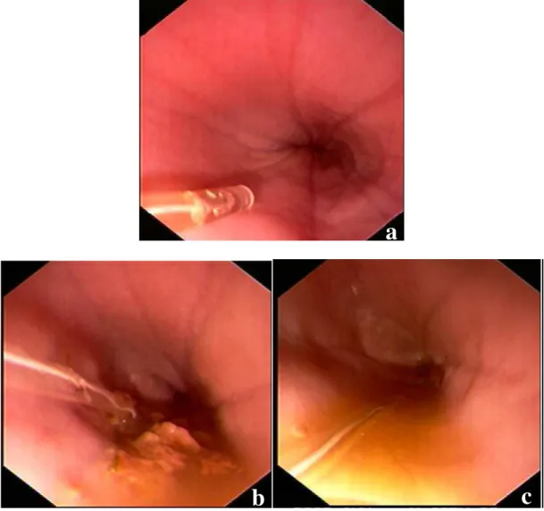 Figura 7- Imagens endoscópicas da região distal do esôfago. Animal sem refluxo 