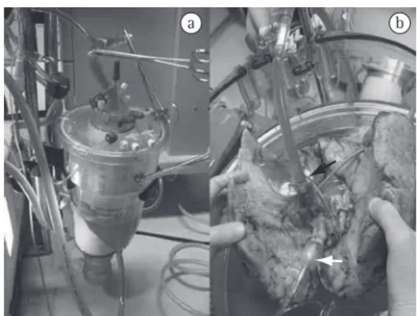 Figure  1  -  In  a),  venous  reservoir  and  membrane  oxygenator  filled  with  the  perfusion  solution