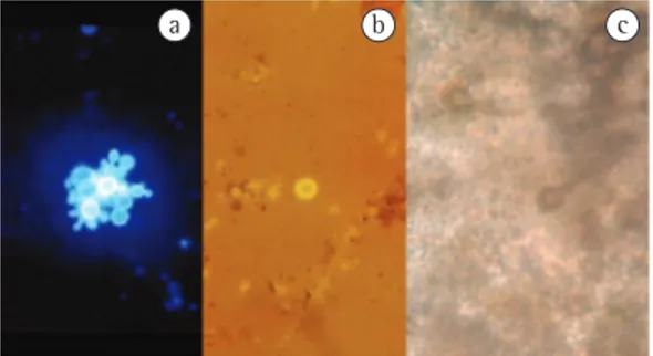 Figure  1  -  a)  Calcofluor  white  staining  revealing  large,  multi-budding  yeast-like  elements  characteristic  of  Paracoccidioides  brasiliensis ;  b)  Nigrosin  staining  revealing  encapsulated  yeast  characteristic  of  Cryptococcus  sp.;  c) 