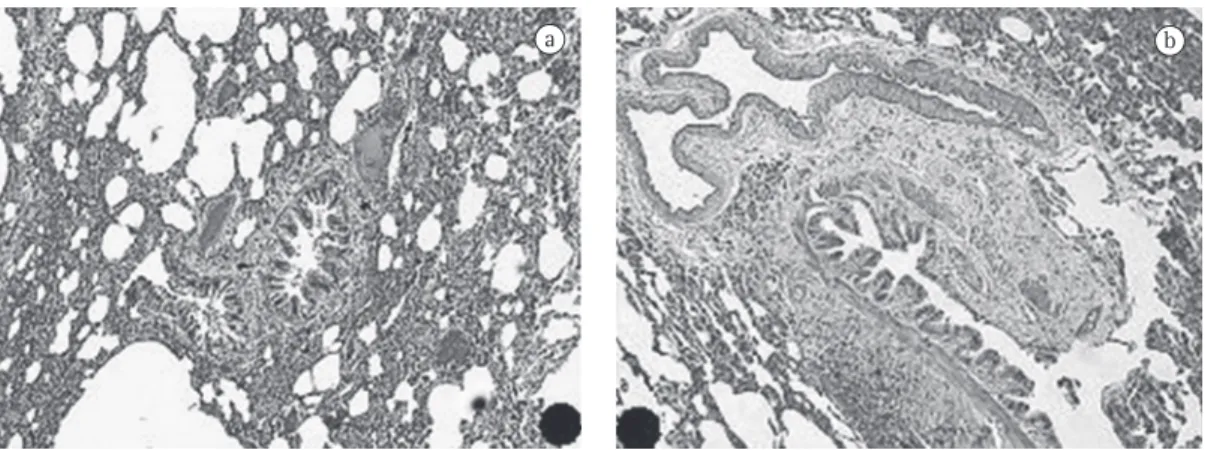Figura 1 - Fotos de microscopia das amostras de tecido pulmonar: a) controle; b) diabéticos (H&amp;E; aumento,  200×).