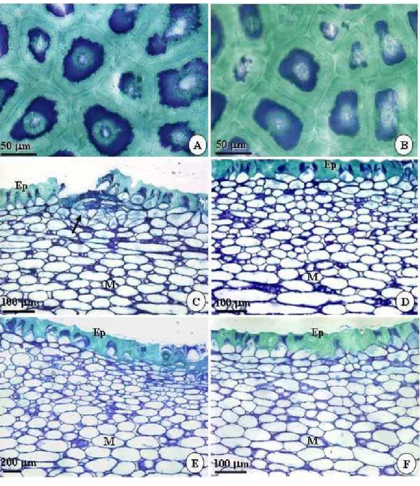 Figura 7 – Fotomicrografias  em  melão Gália 'Solar King' não danificado  mecanicamente (testemunha)