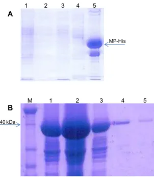 Figura 2. A. Análise em SDS-PAGE das proteínas celulares solúveis e insolúveis de células  de  E